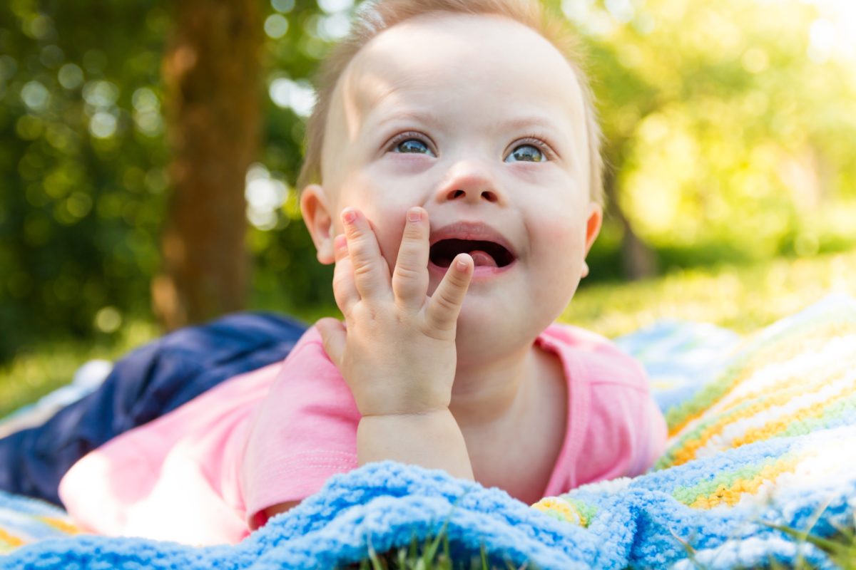 Down Syndrome Baby