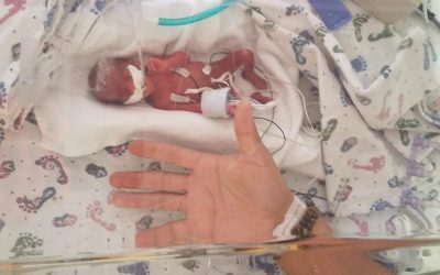 Baby Jaden: The Subjective Standard of Viability